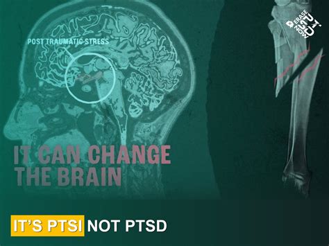 Organization working to change PTSD to PTSI